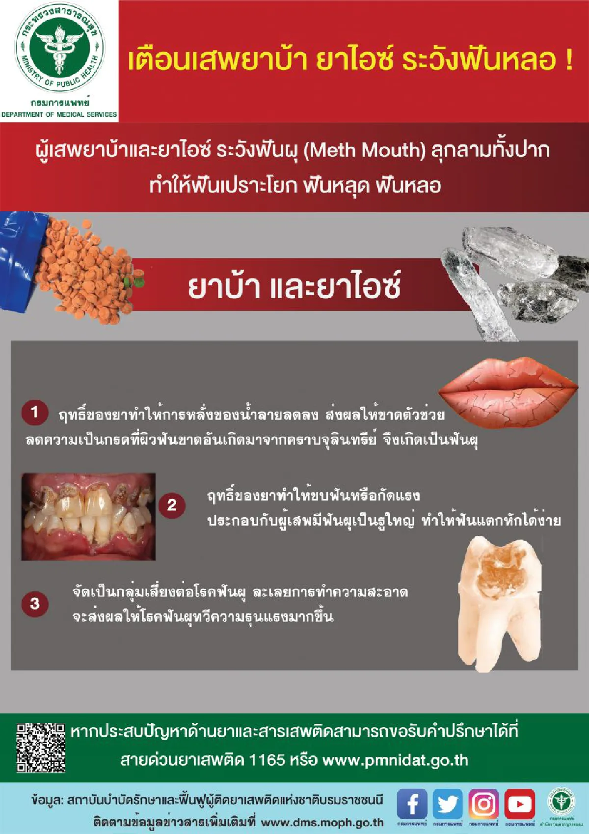 สบยช. เตือนภัยเสพยาบ้า ยาไอซ์ ระวังฟันหลอ