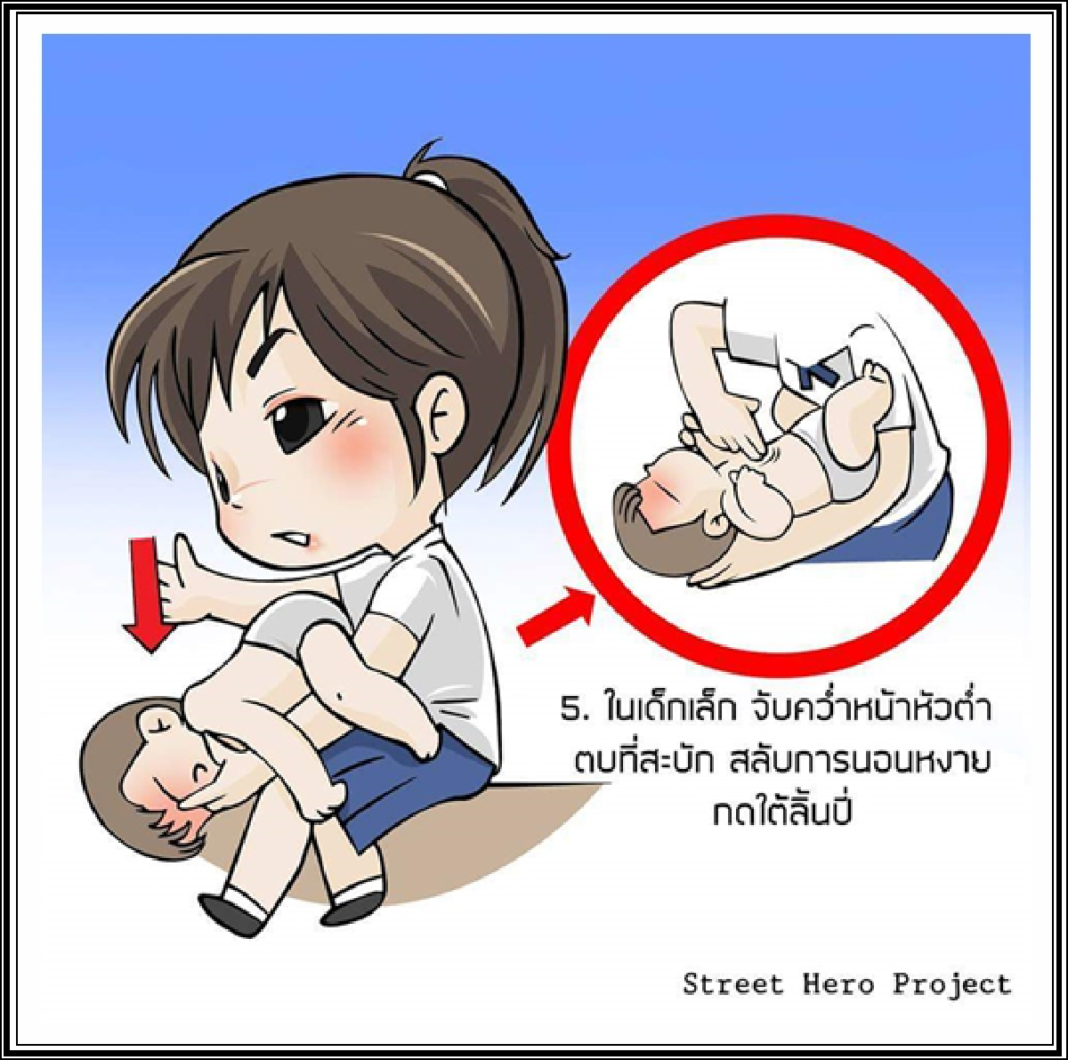สธ.แนะวิธีปฐมพยาบาลสิ่งแปลกปลอมอุดกั้นทางเดินหายใจ