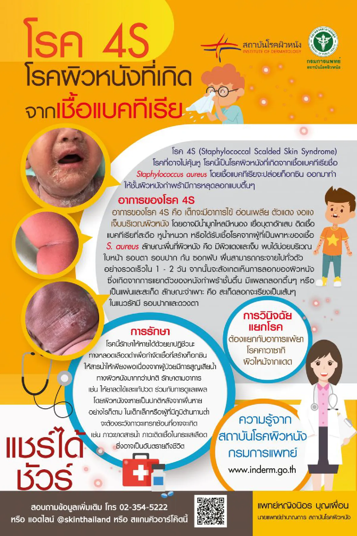 แพทย์ผิวหนัง ชี้ โรค 4S เป็นโรคผิวหนังที่เกิดจากเชื้อแบคทีเรีย