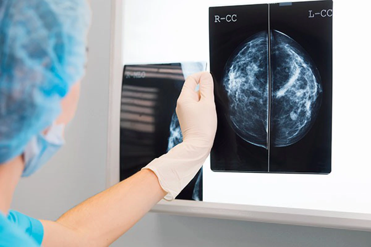 มะเร็งเต้านม....รู้ก่อน รักษาได้ ไม่เสียเต้า...