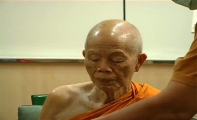 แพทย์ให้ยาหลวงพ่อคูณผ่านหน้าท้อง