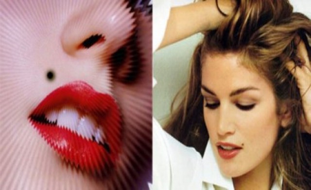 ภัยร้ายซุกซ่อนใต้ไฝดำ