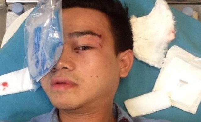 เลขากรณ์โดนตีเย็บ20เข็มแจ้งความแล้ว