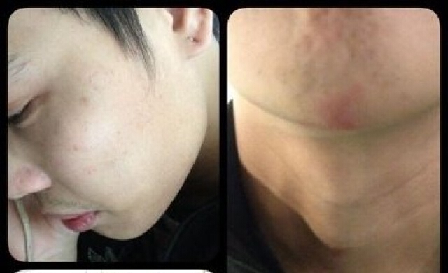 แจ้งจับการ์ด กปปส.รุมตื้บ-ฉกทรัพย์