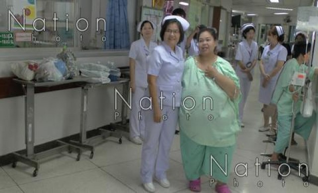 คณะแพทย์มช.เผยสาวอ้วน300กก.ลดเหลือ140กก.แล้ว