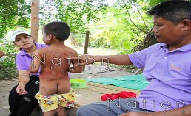 ยายโหดเฆี่ยนหลานชาย5ขวบ เป็นบาดแผลนับร้อย