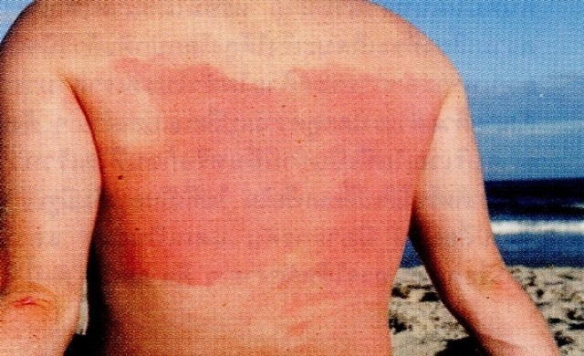 ส.โรคผิวหนังชูเทคนิครักษาโรคผิวหนังเฉพาะราย  