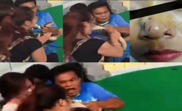 งูโชว์ฉกจมูกสาวจีนเย็บ8เข็ม จี้ผู้ประกอบการป้องกัน