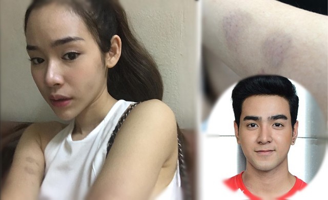 ดาราหนุ่มติดต่อมอบตัวสู้คดี หลังถูกสาวแจ้งจับ