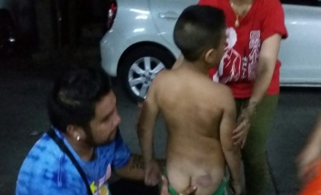 พ่อแม่ร้องสื่อลูกชายถูกครูตีด้วยไม้พลอง99ครั้ง ก้นเขียวช้ำ