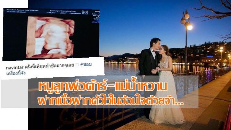 “จมูกโด่ง”เหมือนพ่อดร.ต้าร์ นะจ๊ะ