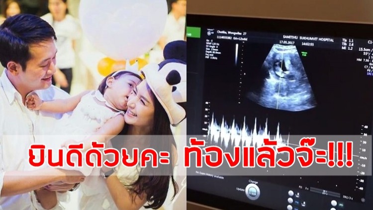 ท้องแล้วจ๊ะ!!! ว่าที่คุณแม่คนใหม่ “เนย-โชติกา” 