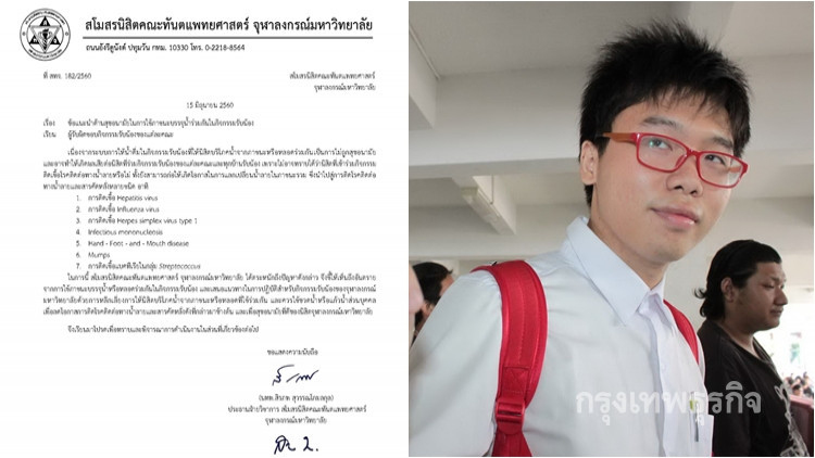 ทันตะจุฬาฯห้ามกิจกรรมรับน้องแลกน้ำลายเสี่ยงติดโรค!!!