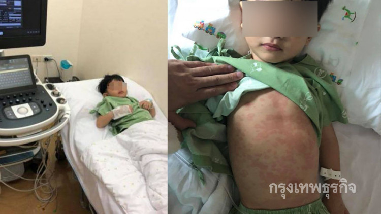 เตือนภัย! 'โรคคาวาซากิ' ภัยร้ายในเด็ก