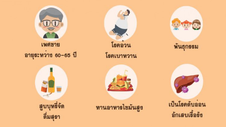 เตือน! กลุ่มเสี่ยงมะเร็งตับอ่อน 