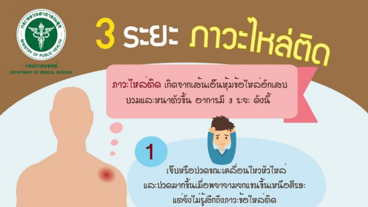 ปวดหัวไหล่ ยกแขนไม่ขึ้น สัญญาณอันตรายเสี่ยงภาวะไหล่ติด