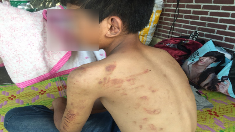 เด็กวัย 14 สุดทน! ถูกแม่เลี้ยงทุบตีนาน 7 ปี หนีออกจากบ้านไปหาแม่แท้ๆ