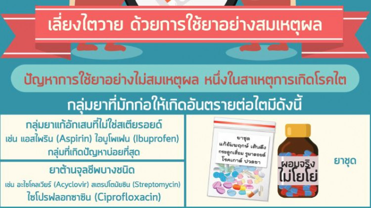 สธ. เตือนระวังการใช้ยาแก้ปวดกลุ่มเอนเสด ลดความเสี่ยงไตวาย