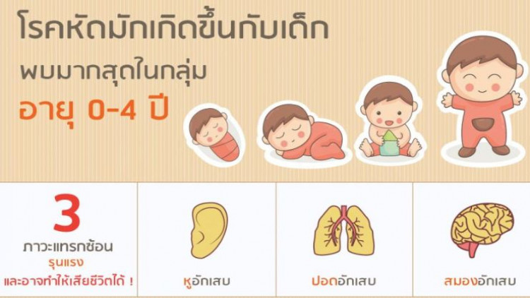 กรมควบคุมโรค ติดตามสถานการณ์โรคหัด ในพื้นที่ภาคใต้ตอนล่างอย่างใกล้ชิด