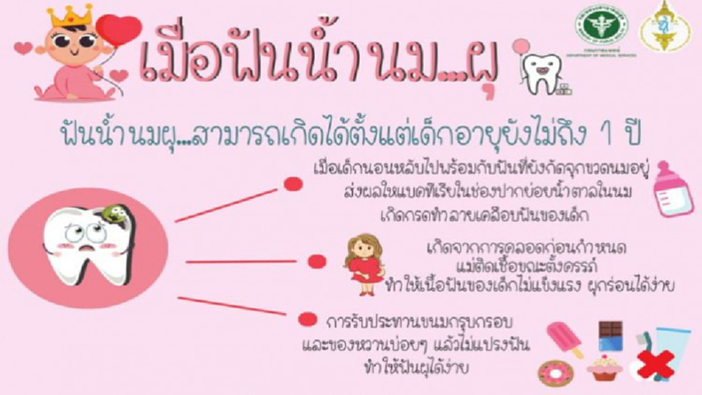 แพทย์แนะพ่อแม่ดูแลฟันน้ำนมลูก อย่าให้เสียไปก่อนวัยอันควร