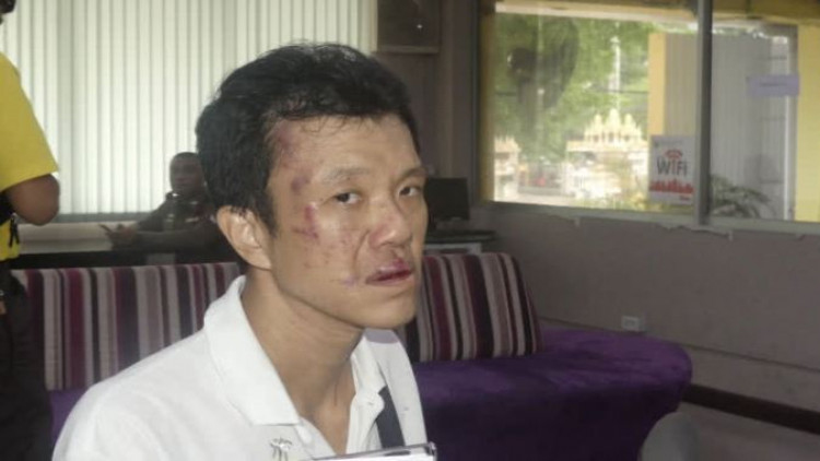 โดนอีก 'เอกชัย' ถูกรุมตื้บเจ็บหนัก