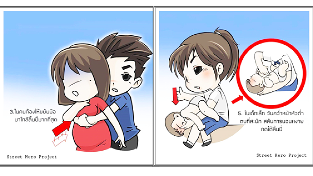 สธ.แนะวิธีปฐมพยาบาลสิ่งแปลกปลอมอุดกั้นทางเดินหายใจ