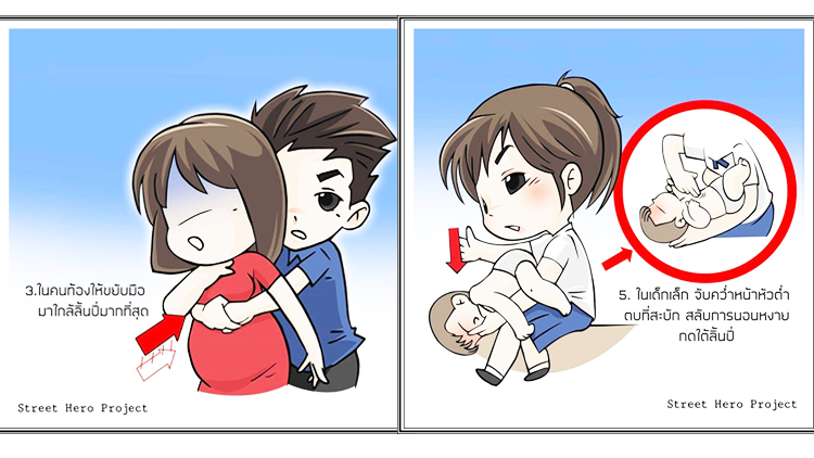 สธ.แนะวิธีปฐมพยาบาลสิ่งแปลกปลอมอุดกั้นทางเดินหายใจ