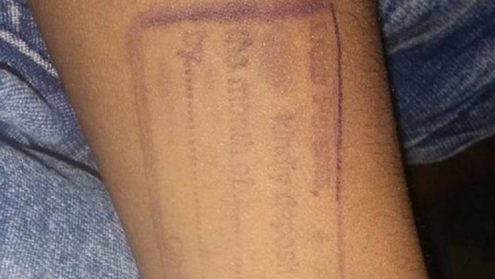 โรงเรียนอินเดียทวงค่าเทอมด้วยวิธี"สแตมป์"แขนเด็ก