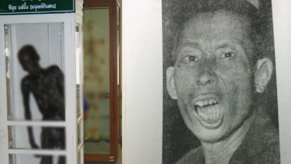 ศิริราชปลดป้าย 'ซีอุย มนุษย์กินคน'