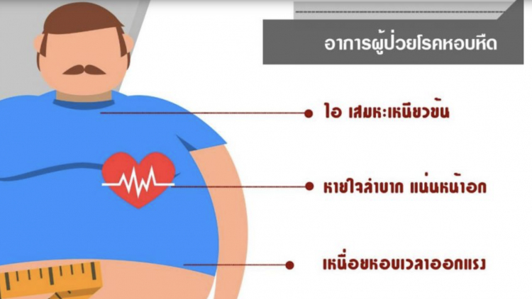 เตือนโรคอ้วนลงพุง ทำให้ระบบหายใจทำงานติดขัด ก่อให้เกิดโรคหอบหืด