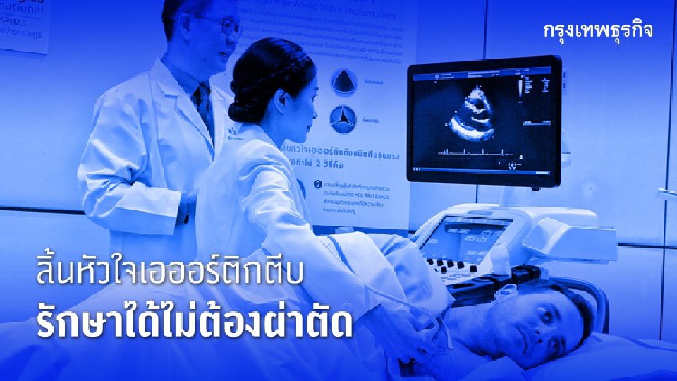 โรคลิ้นหัวใจเอออร์ติกตีบรักษาได้ ใช้เทคนิค TAVI โดยไม่ต้องผ่าตัด
