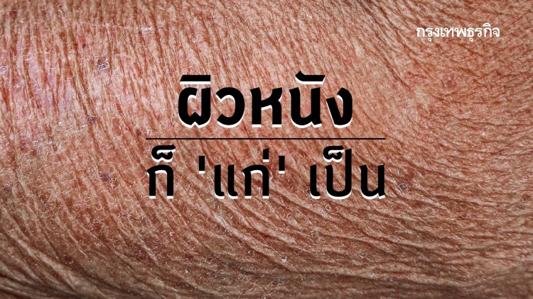 เกิดอะไรขึ้น.. เมื่อผิวหนังแก่