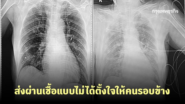 'หมอโอภาส' โพสต์ การส่งผ่านเชื้อแบบไม่ได้ตั้งใจให้คนรอบข้าง