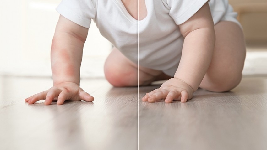 ‘COVID-19’ กับ‘คาวาซากิ’ในเด็กเล็ก