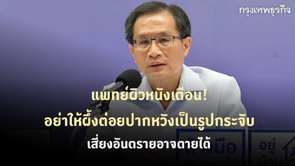 แพทย์เตือน! อย่าให้ผึ้งต่อยปากหวังเป็นรูปกระจับ เสี่ยงอันตรายอาจตายได้