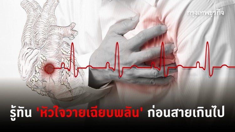 ถอดบทเรียนเคส ‘รองอธิบดีกรมควบคุมโรค’ รู้ทัน ‘หัวใจวายเฉียบพลัน’