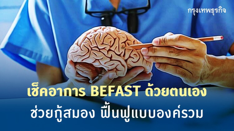 เช็คง่ายๆ "โรคหลอดเลือดสมอง"ด้วยตนเอง