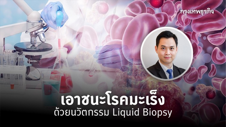 เอาชนะโรคมะเร็งด้วยนวัตกรรม Liquid Biopsy