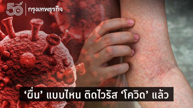 ‘ผื่น’แบบไหน บอกว่า ติด "โควิด19"แล้ว