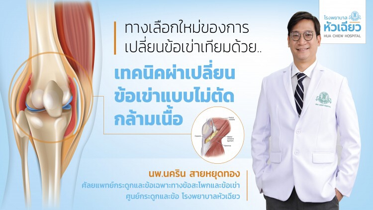 “ทางเลือกใหม่ของการเปลี่ยนข้อเข่าเทียมด้วย.. เทคนิคผ่าเปลี่ยนข้อเข่าแบบไม่ตัดกล้ามเนื้อ”