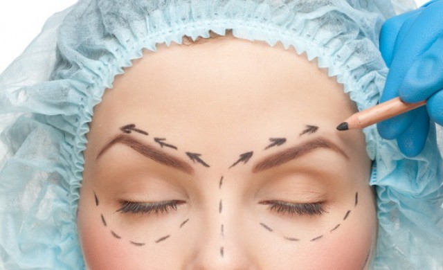 Full Face Lift Surgery