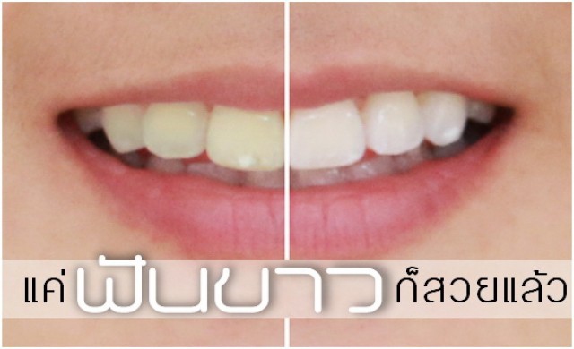 “ฟันขาว” แล้ว “หน้าเด็กลง” จริงไหม?