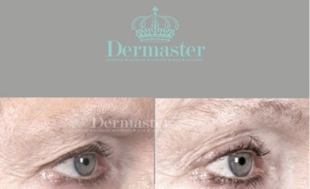 ปัญหาขอบตาคล้ำ