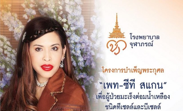 โรงพยาบาลจุฬาภรณ์ สานต่อพระปณิธานจัดโครงการ “เพท-ซีที สแกน”