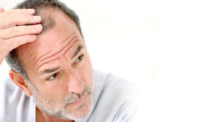 ปลูกผมด้วยเทคนิคพิเศษไม่ต้องผ่าตัด