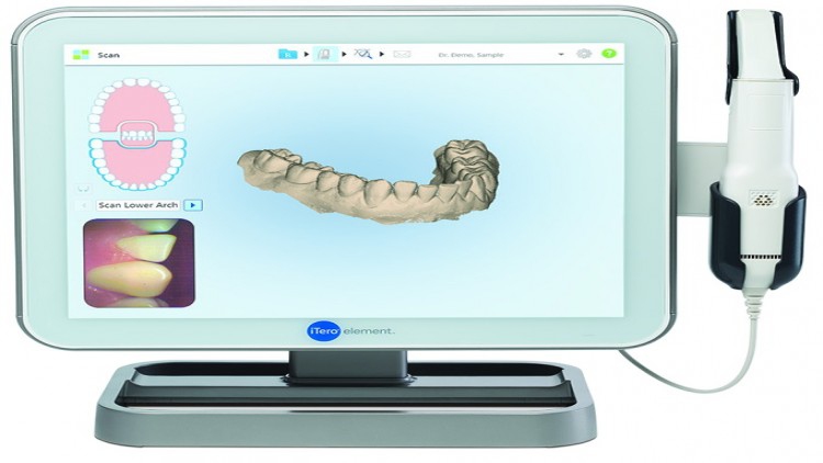 iTero Element เครื่องสแกนฟันดิจิทัล 3 มิติ
