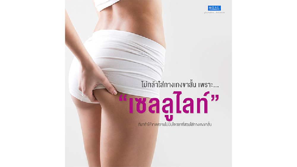 ไม่กล้าใส่กางเกงขาสั้น เพราะ "เซลลูไลท์" รึเปล่า