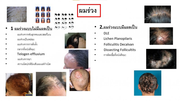 หลักปฏิบัติ 5 ประการในการดูแลเส้นผมและหนังศีรษะช่วง Work From Home