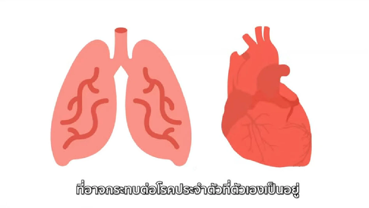 สมาคมศัลยแพทย์ทรวงอกฯ ชี้ ผู้ป่วยโรคหัวใจ และโรคปอด ควรเร่งฉีด “วัคซีนโควิด-19”