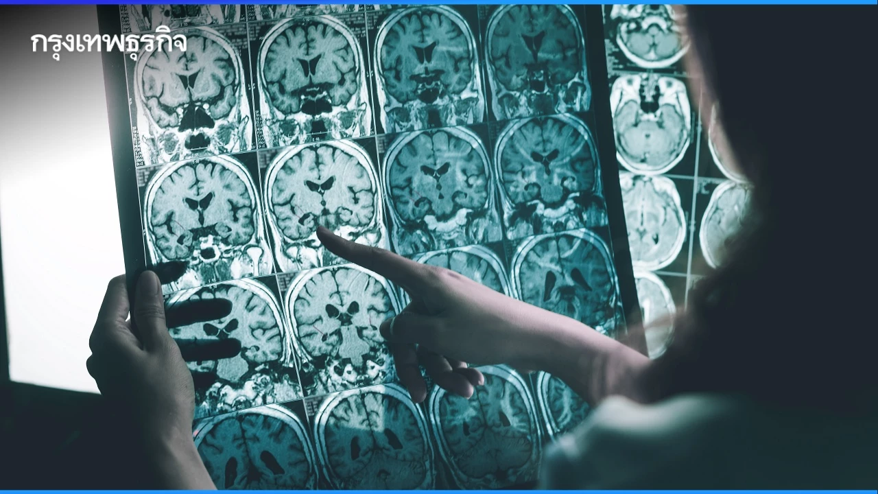 ไม่แก่ก็เป็น "อัลไซเมอร์" ได้! เช็ก 5 สัญญาณคุณมีอาการเหล่านี้หรือไม่?